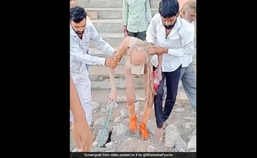 Viral Video Claims '188-Year-Old' Man Rescued In Bengaluru